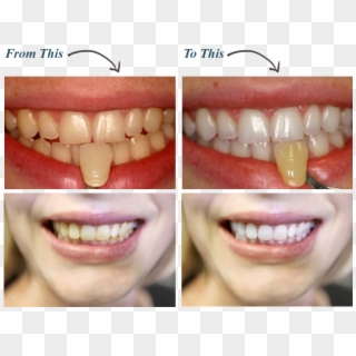 Dentist In Savannah Ga Dental Solutions Common - My Teeth White Clipart