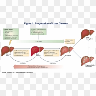 A Number Of Companies Are Currently Developing Treatments - Overview Liver Disease Clipart