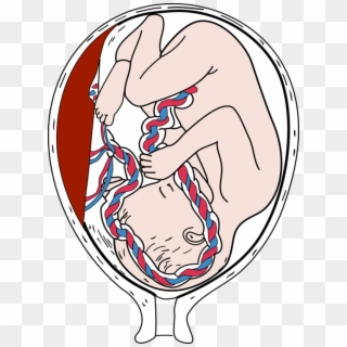 Fetus Placenta Pregnancy Infant Embryo - Placenta Clipart - Png Download