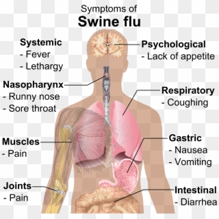 Symptoms Of Swine Flu - Dic Hemolytic Transfusion Reaction Clipart