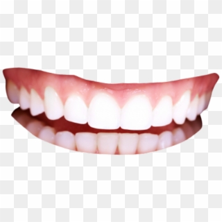 640 X 480 5 - Human Teeth Png Clipart
