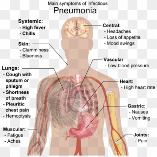 Main Symptoms Of Infectious Pneumonia - Pneumonia Symptoms Clipart
