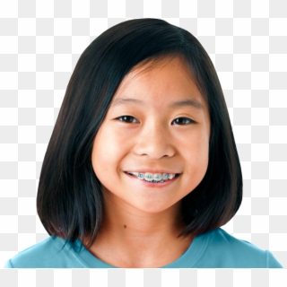 Girl-braces - Girl Braces Transparent Png Clipart