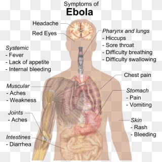 Symptoms Of Ebola Clipart