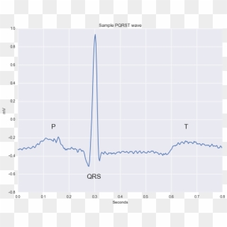 Waveform From An Actual Ecg Recording - Plot Clipart