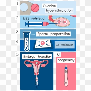 Intracytoplasmic Sperm Injection Clipart