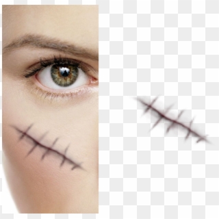 616 X 600 12 - Stitches On Face Png Clipart