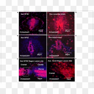 Xenopus And Axolotl Cell Proliferation - Graphic Design Clipart