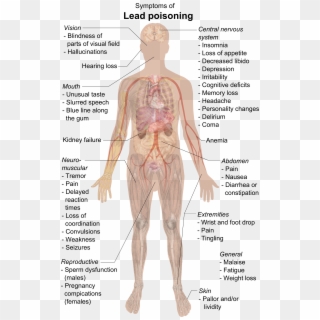 Symptoms Of Lead Poisoning - Lead Poisoning Symptoms Clipart