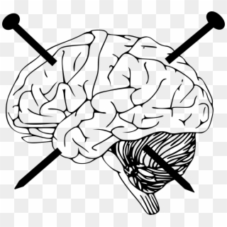 Physical Brain Damage And Amnesia - Brain Pic Black And White Clipart