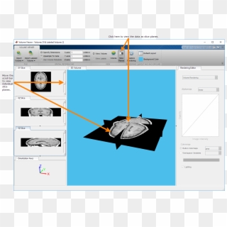 You Can Also Zoom In And Rotate This View Of The Data - Matlab Volume Viewer App Clipart