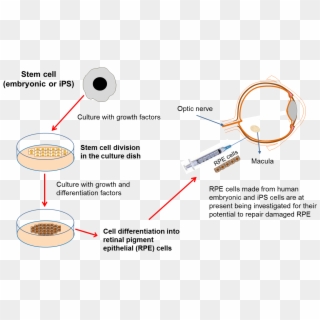 Diagram On Developing Eye Therapies - Stem Cells In Eye Clipart
