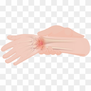 Wrist Pain - Glove Clipart