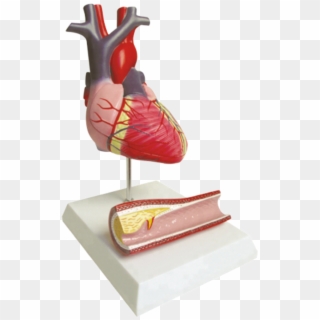 Diseased Heart Model, Diseased Heart Model Suppliers - Figurine Clipart