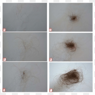 Hair Shedding Scale - Dandelion Clipart