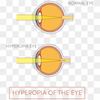 Illustration Of Human Eye - Circle Clipart