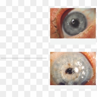 Ocular Surface Disease - Close-up Clipart
