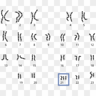 Chromosomes-abnormal - Abnormal Chromosomes Clipart