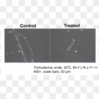 Morphological Study Of Trichoderma Viride Maff 30546 - Earthworm Clipart
