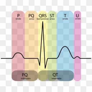 File - Ekg-komplekso Eo - Svg - Conduction System Of The Heart Ecg Clipart
