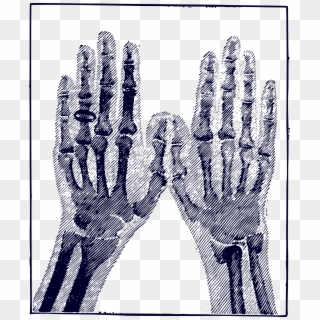 This Free Icons Png Design Of X-ray Image - X Ray Hand Png Vector Free Illustrator Clipart
