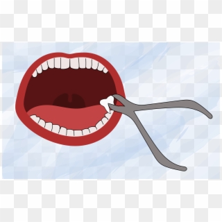 Tooth Clipart Png - Wisdom Teeth Clip Art Transparent Png