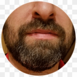 Is This A Reason To Grow A Beard - Close-up Clipart