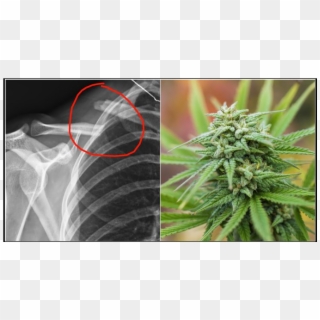 Who'd Of Thought That Smoking A Joint Could Be A Remedy - Marijuana Plants Up Close Clipart