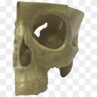 Front Of 3d Printed Half Skull - Skull Clipart