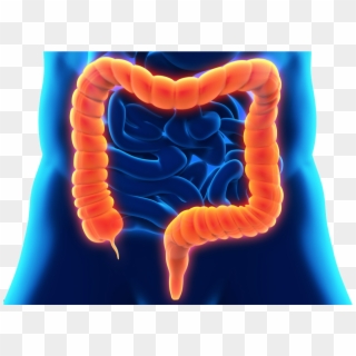 Inflammatory Bowel Disease Dr - Tocoma Colon Cleanser Review Clipart