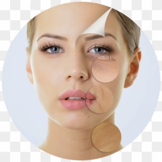 Kisspng Chemical Peel Skin Wrinkle Facial Exfoliation - Anti Age Procedūra Clipart