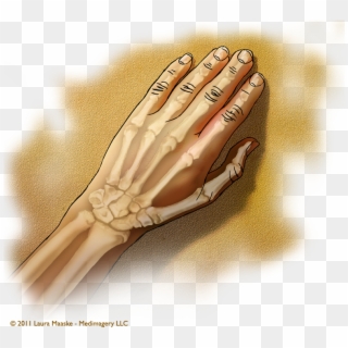 Tips For Artists Who Would Like Medical Illustration - Transparent Hand Anatomy Clipart