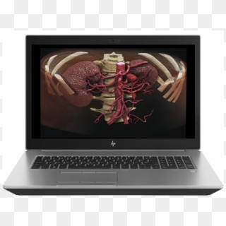 Mobile Workstation - Hp G5 17 Clipart