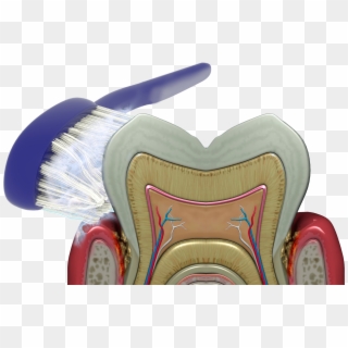 Brushing, Rinsing And Flossing Cannot Reach The Bacteria - Brush Clipart