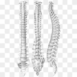 Spine Png - T4 To L1 Spinal Fusion Clipart