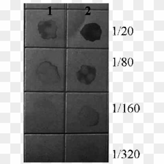 Inmunoensayo En Membrana De Nitrocelulosa Con Un Rango - Tile Clipart