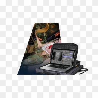 Leonardo Nano - Portable Medical Device Military Clipart