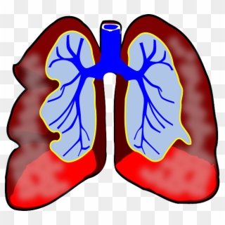 Boston Scientific Brings Next Generation Asthma Therapy - Lungs Clip Art - Png Download