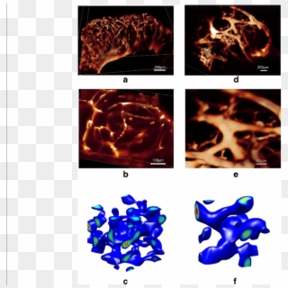 Alterations Of The 3d Self-organized Vmc Multicellular - Flame Clipart