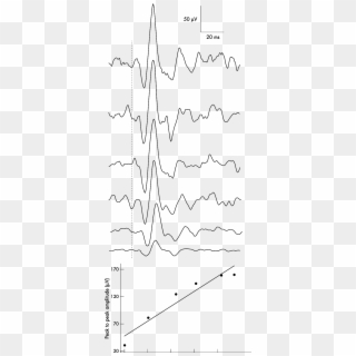 The Effect Of Background Electromyographic Activity - Line Art Clipart