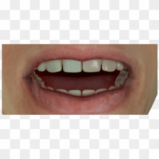 Teeth Test6 960×540 130 Kb - Tongue Clipart