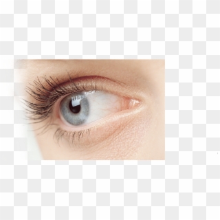 Monovision Lasik Eye Surgery - Under Eye Area Clipart