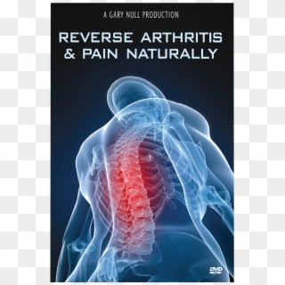 Reverse Arthritis & Pain Naturally Dvd - Chiropractic Care Clipart