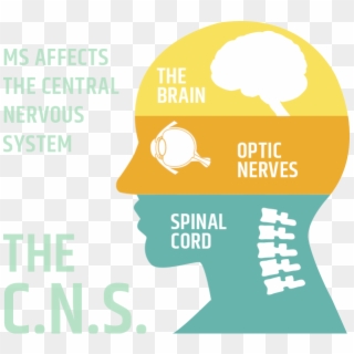 Centeral Nervous System - Multiple Sclerosis Central Nervous System Clipart