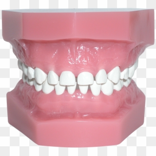 Pedo Model With High Heat Teeth - Teeth Model Png Clipart