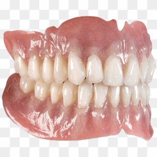 Implant Supported Dentures Are The Best Form Of False - Dental Prosthesis Clipart