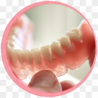 You May Experience An Adjustment Period With Your First - Horseshoe Upper Denture Without Implants Clipart