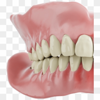 Front Denture - Dentures Clipart
