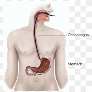 Illustration Showing An Endoscopic Ultrasound - Upper Gi Clipart