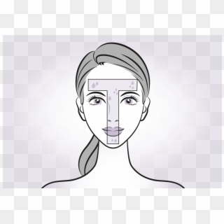 What Happens During The Procedure - Face Sweating Botox Clipart